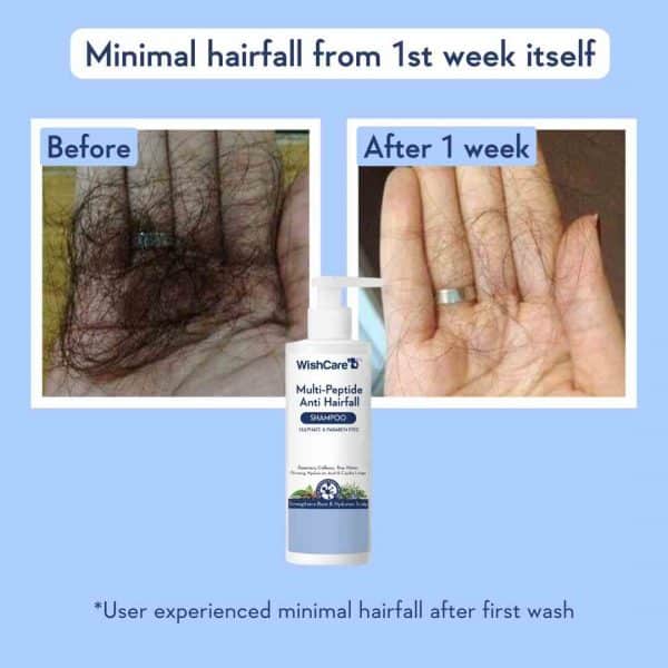 Before and after comparison showing reduced hairfall after one week of using WishCare Multi Peptide Anti Hairfall Shampoo.