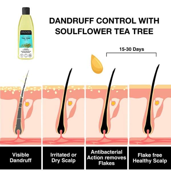 Soulflower Tea Tree Anti Dandruff Scalp Oil