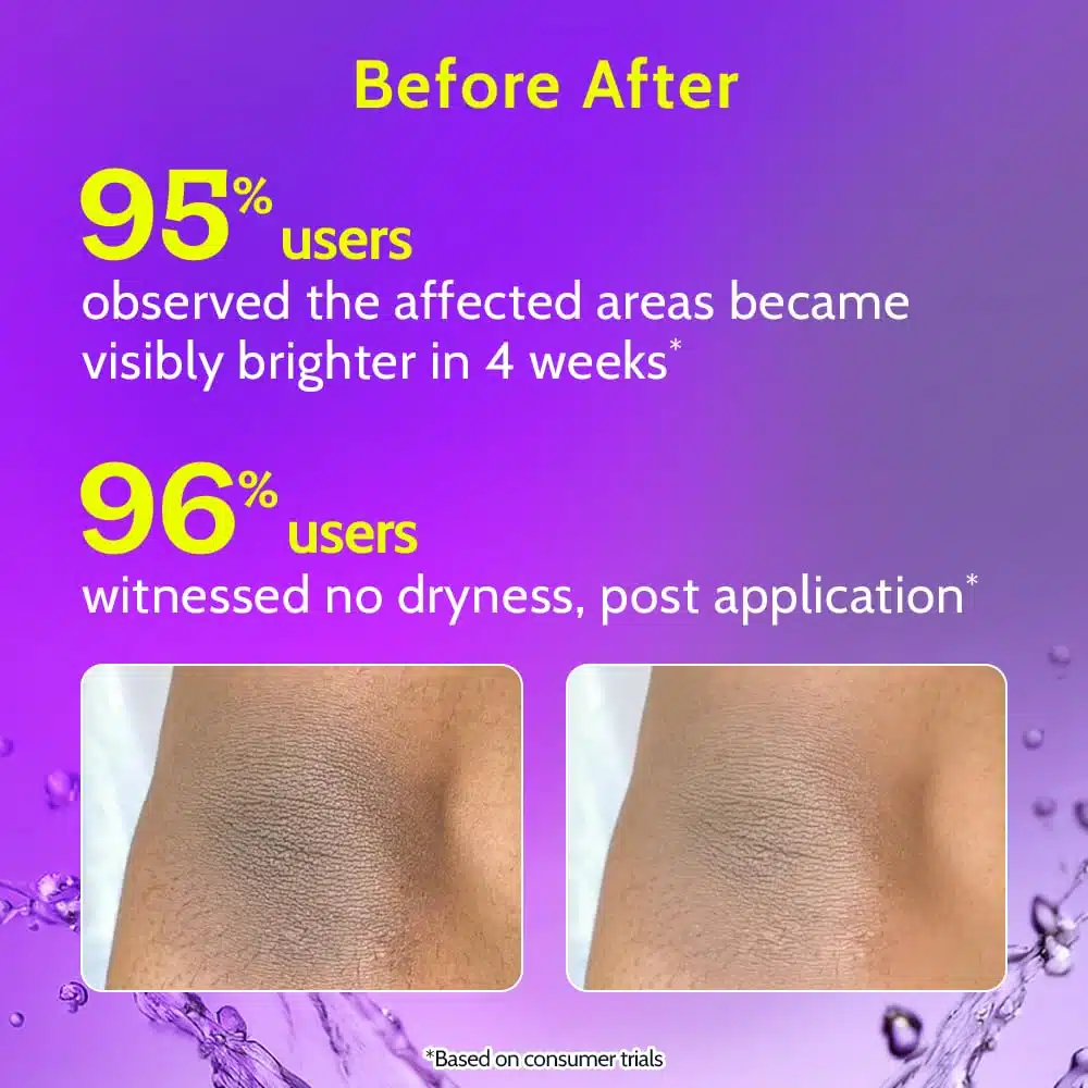 chemist at play neck knee elbow brightening roll on4