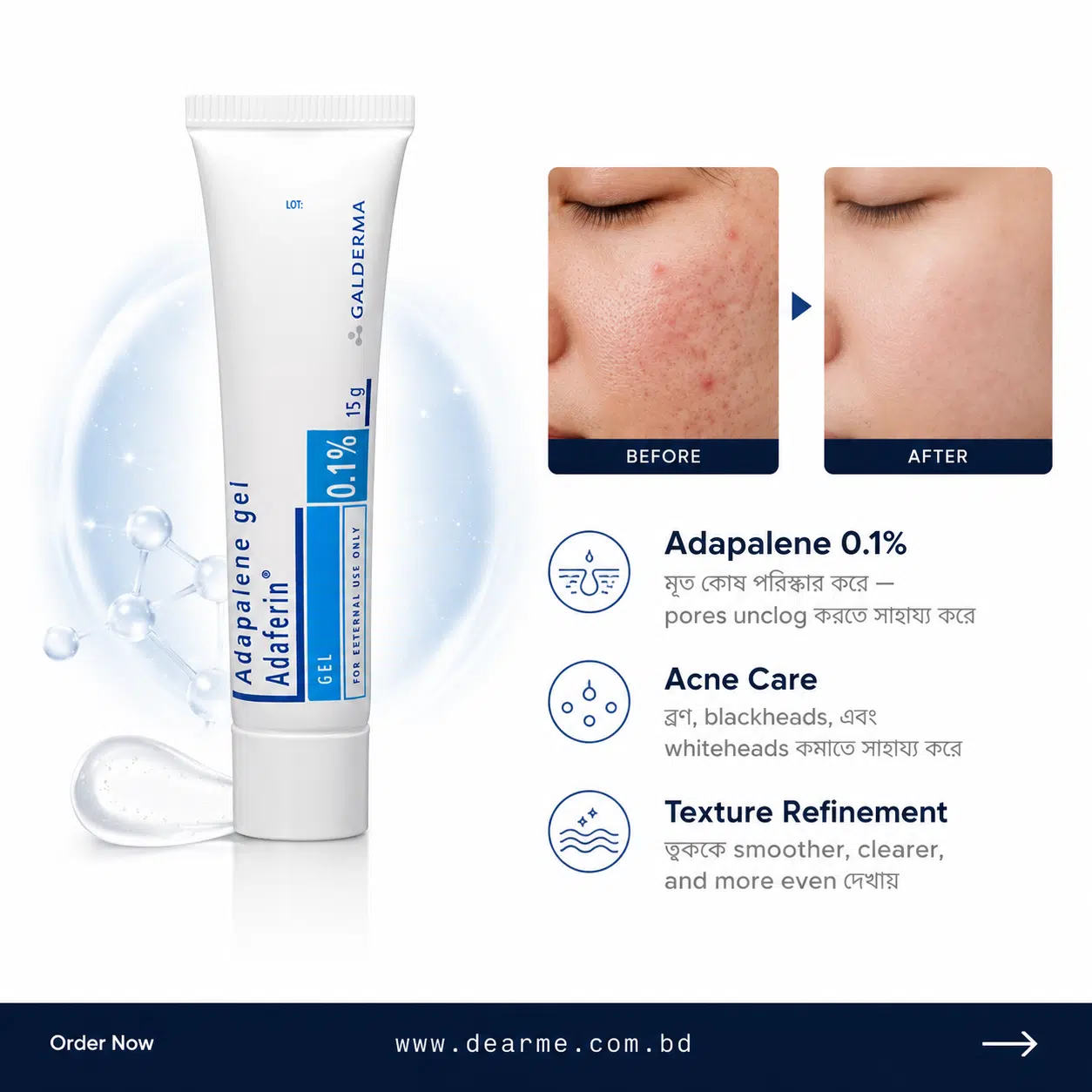 Galderma Adaferin Adapalene Gel 0.1% (15g) Galderma Adaferin Adapalene Gel 0.1% (15g)